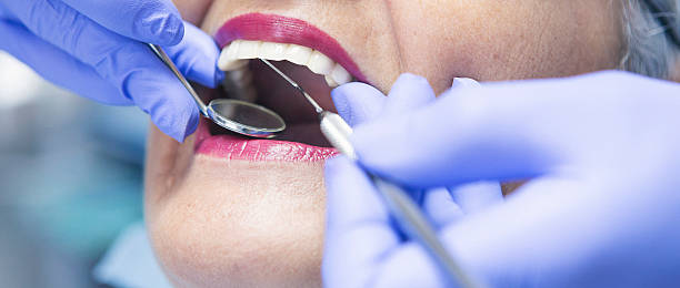 Best Urgent Care for Lost Fillings or Crowns in Elma, WA